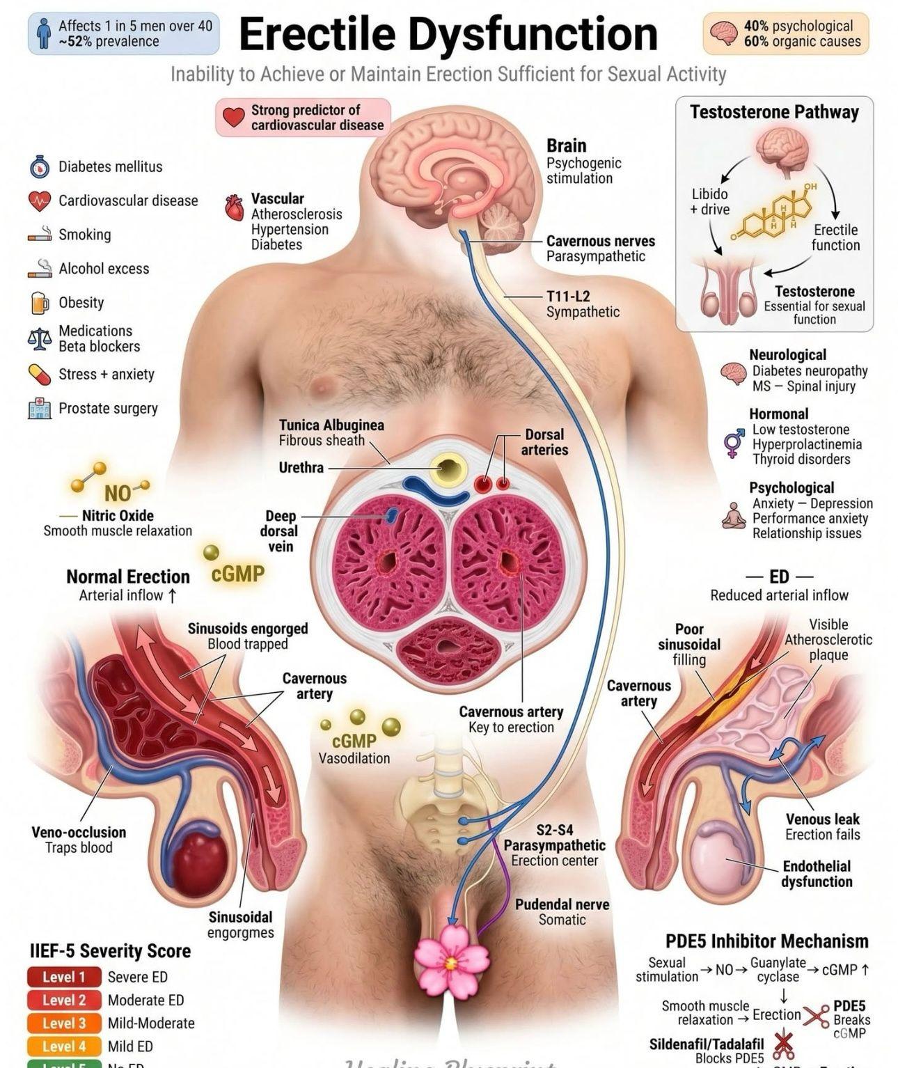 The Erection: A Vascular Deep-Dive — Why erections fail — the three failure modes