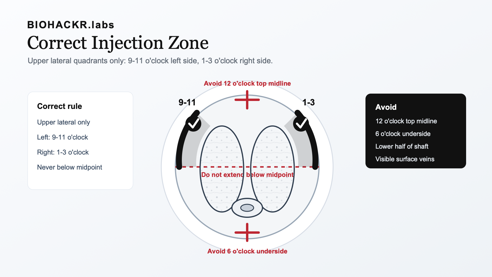 Medical schematic showing upper lateral ICI injection zones at 9 to 11 o'clock and 1 to 3 o'clock, with top midline, underside, and lower half marked as avoid zones.